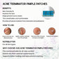 Acne Terminator Pimple Patches